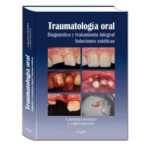 Mendoza – Tratumatología Oral: Diagnóstico y Tratamiento Integral, Soluciones Estéticas  1 Ed. 2012