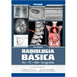 Ulloa – Radiología Básica: Rx-Tc-Rm- Ecografía 3 Ed. 2024