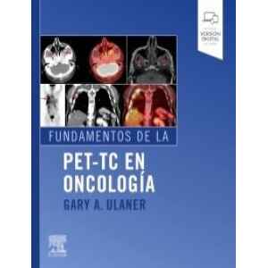 Ulaner – Fundamentos de la PET-TC en Oncología 1 Ed. 2020