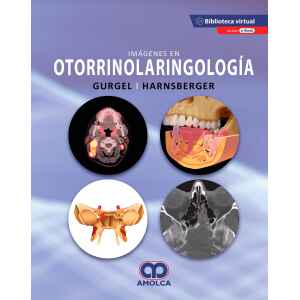 Gurgel – Imágenes en Otorrinolaringología + E-Book 1 Ed. 2020