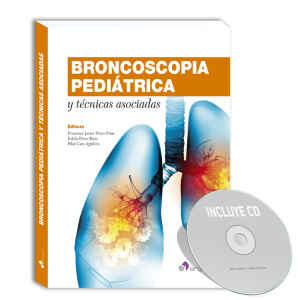 Pérez – Broncoscopia Pediátricas: Técnicas Asociadas 1 Ed. 2014