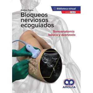 Tognù – Bloqueos Nerviosos Ecoguiados. Sonoanatomía Básica y Avanzada + E-Book 1 Ed. 2020