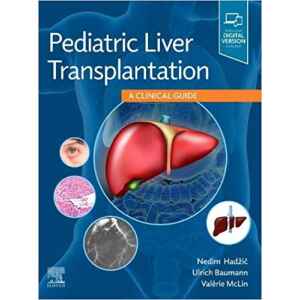 Hadzic – Pediatric Liver Transplantation: A Clinical Guide 1 Ed. 2021