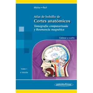 Möller – Atlas de Bolsillo de Cortes Anatómicos Tomo 1. Tomografía computarizada y resonancia magnética: Cabeza y Cuello 4 Ed. 2015