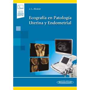 Alcázar – Ecografía en Patología Uterina y Endometrial 1 Ed. 2021 (Incluye eBook)