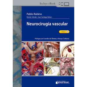 Rubino – Neurocirugía vascular 1 Ed. 2021