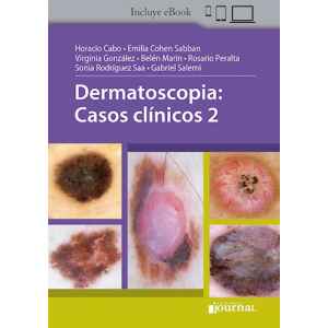 Cabo – Dermatoscopia: Casos clínicos 2 1 Ed. 2021