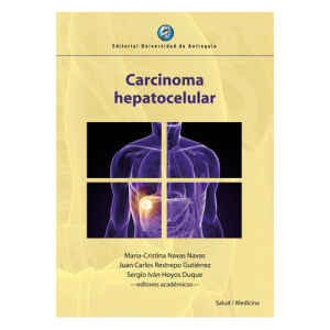 Navas – Carcinoma hepatocelular 1 Ed. 2017