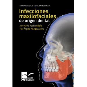Radi – Infecciones maxilofaciales de origen dental 1 Ed. 2021