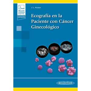 Alcazar – Ecografía en la Paciente con Cáncer Ginecológico 1 Ed. 2022