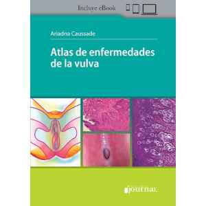 Caussade – Atlas de enfermedades de la vulva 1 Ed. 2022