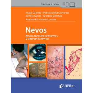 Cabrera – Nevos, Tumores Neviformes y síndromes Névicos 1 Ed. 2023