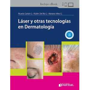 Galván – Láser y Otras Tecnologías en Dermatología 1 Ed. 2024