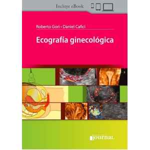 Cafici – Ecografía Ginecológica 1 Ed. 2023
