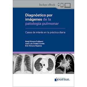 Kimura – Diagnóstico por Imágenes de la Patología Pulmonar 1 Ed. 2024