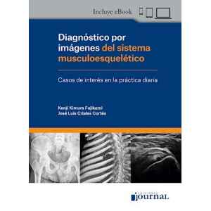 Kimura – Diagnóstico por Imágenes del Sistema Musculoesquelético 1 Ed. 2022