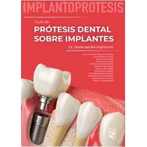 Highsmith – IMPLANTOPRÓTESIS: Guía de Prótesis Dental sobre Implantes 1 Ed. 2024