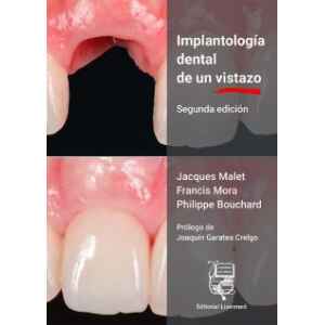 Malet – Implantología Dental de un Vistazo 2 Ed. 2023