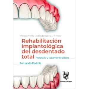 Pedrola – Rehabilitación Implantológica del Desdentado Total: Protocolo y tratamiento clínico 1 Ed. 2024