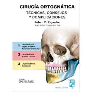 Reyneke – Cirugía Ortognática: Técnicas, Consejos y Complicaciones 1 Ed. 2023