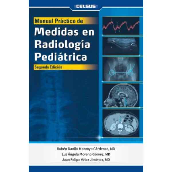 Montoya - Manual Práctico de Medidas en Radiología Pediátrica 2 Ed. 2026